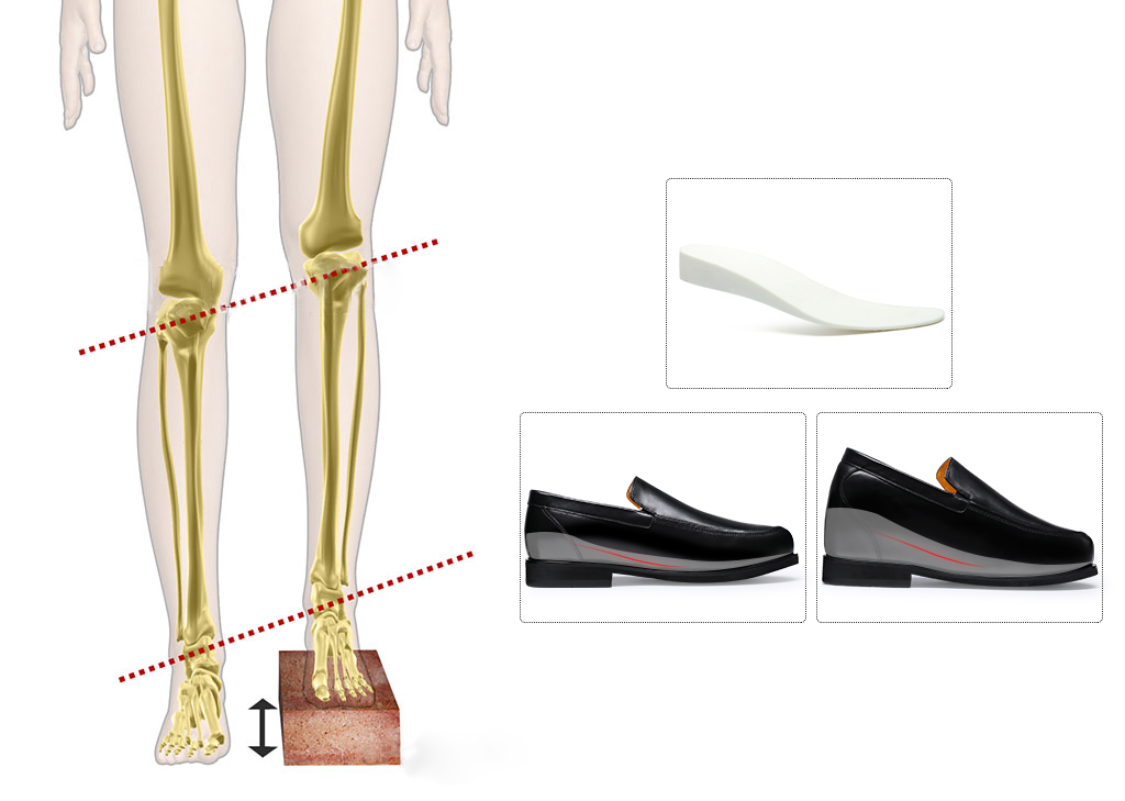 zapatos a medida para la discrepancia de longitud de las piernas